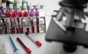 oxford covid19 saakshatv