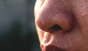 Saakshatv healthtips sweating 