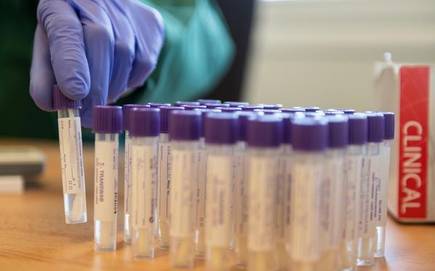 ಕೊರೊನಾ ವಿರುದ್ದದ ಹೋರಾಟಕ್ಕೆ ಕೇರಳ ಸರ್ಕಾರದ ಸಹಾಯ ಕೇಳಿದ ಮಹಾರಾಷ್ಟ್ರ…