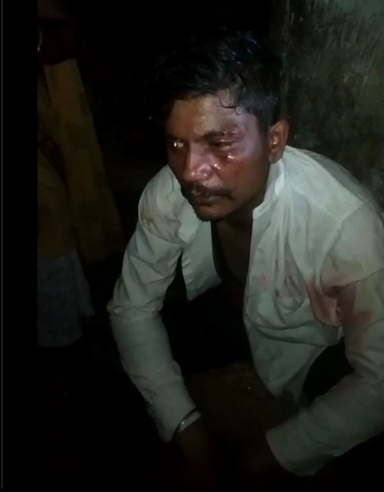 ಕೊರೊನಾ ವಾರಿಯರ್ಸ್ ಮೇಲೆ ತಾಂಡಾ ನಿವಾಸಿಗಳ ಹಲ್ಲೆ, ಆಂಬ್ಯುಲೆನ್ಸ್ ಜಖಂ