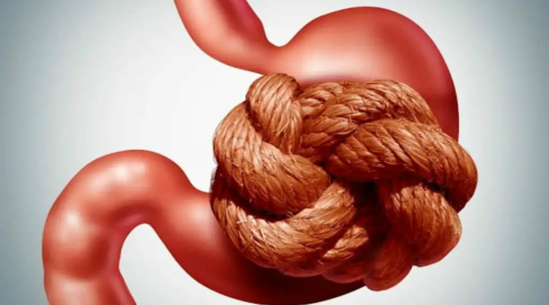 ಹೊಟ್ಟೆಯಲ್ಲಿ ಗ್ಯಾಸ್ ಉಬ್ಬರ  ನಿವಾರಿಸಲು 5 ಸರಳ ತ್ವರಿತ ವಿಧಾನ