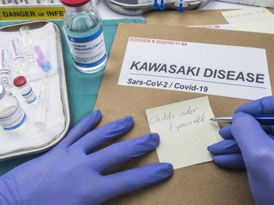 ಕೊರೋನಾ ಸೋಂಕಿಗೆ ಒಳಗಾದ ಮಕ್ಕಳಲ್ಲಿ ಕಾಣಿಸಿಕೊಂಡ ಕವಾಸಕಿ