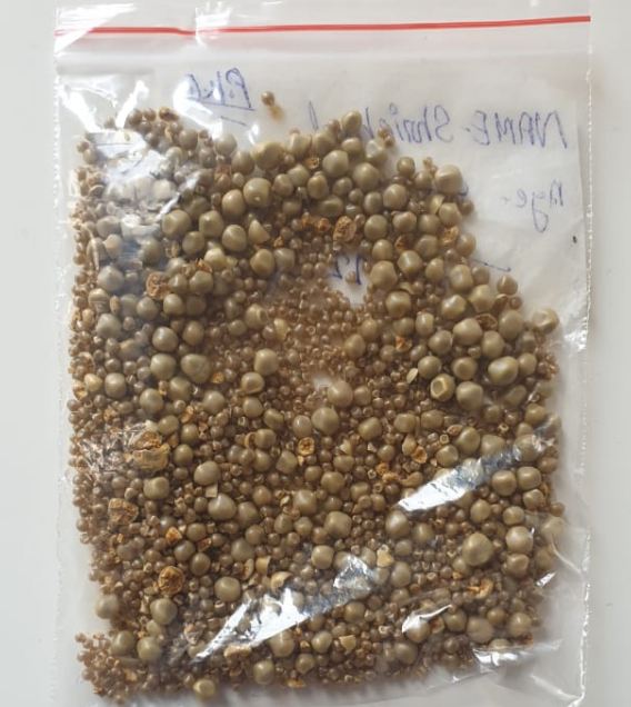 80ರ ವೃದ್ಧನ ಹೊಟ್ಟೆಯಲ್ಲಿ 2,215 ಕಲ್ಲುಗಳು ಪತ್ತೆ