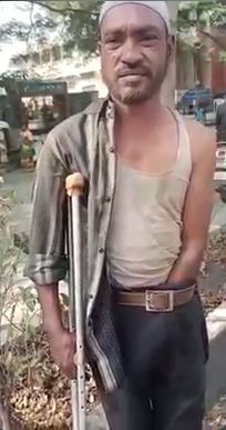 ಕೈ ಇದ್ದರೂ ವಿಕಲಚೇತನನಂತೆ ನಟನೆ –  ಭಿಕ್ಷುಕನ ಅಸಲಿ ಮುಖ ಬಯಲು