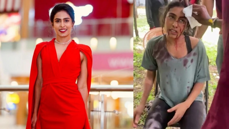 Samyuktha Hegde – ಶೂಟಿಂಗ್ ವೇಳೆ  ಗಂಭೀರವಾಗಿ ಗಾಯಗೊಂಡ ನಟಿ ಸಂಯುಕ್ತಾ ಹೆಗಡೆ