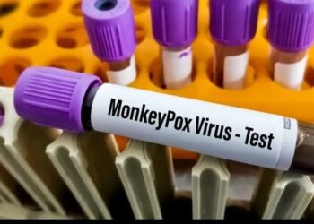 Monkeypox in Delhi –  ದೆಹಲಿಯಲ್ಲಿ ಮಂಕಿಪಾಕ್ಸ್ ಐದನೇ ಪ್ರಕರಣ ಪತ್ತೆ..