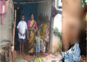 teacher burns 3 year old boy’s private parts