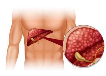 ಲಿವರ್ ಕ್ಯಾನ್ಸರ್ ( liver cancer )ನ ಲಕ್ಷಣಗಳು