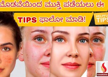 ಮೊಡವೆಯಿಂದ ಮುಕ್ತಿ ಪಡೆಯಲು ಈ TIPS ಫಾಲೋ ಮಾಡಿ!