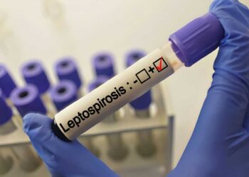 ರಾಜ್ಯದಲ್ಲಿ ಡೆಂಗ್ಯೂ ಮಾದರಿಯ ಲೆಪ್ಟೋಸ್ಪೈರೋಸಿಸ್ ಸೋಂಕು ಹೆಚ್ಚಳ